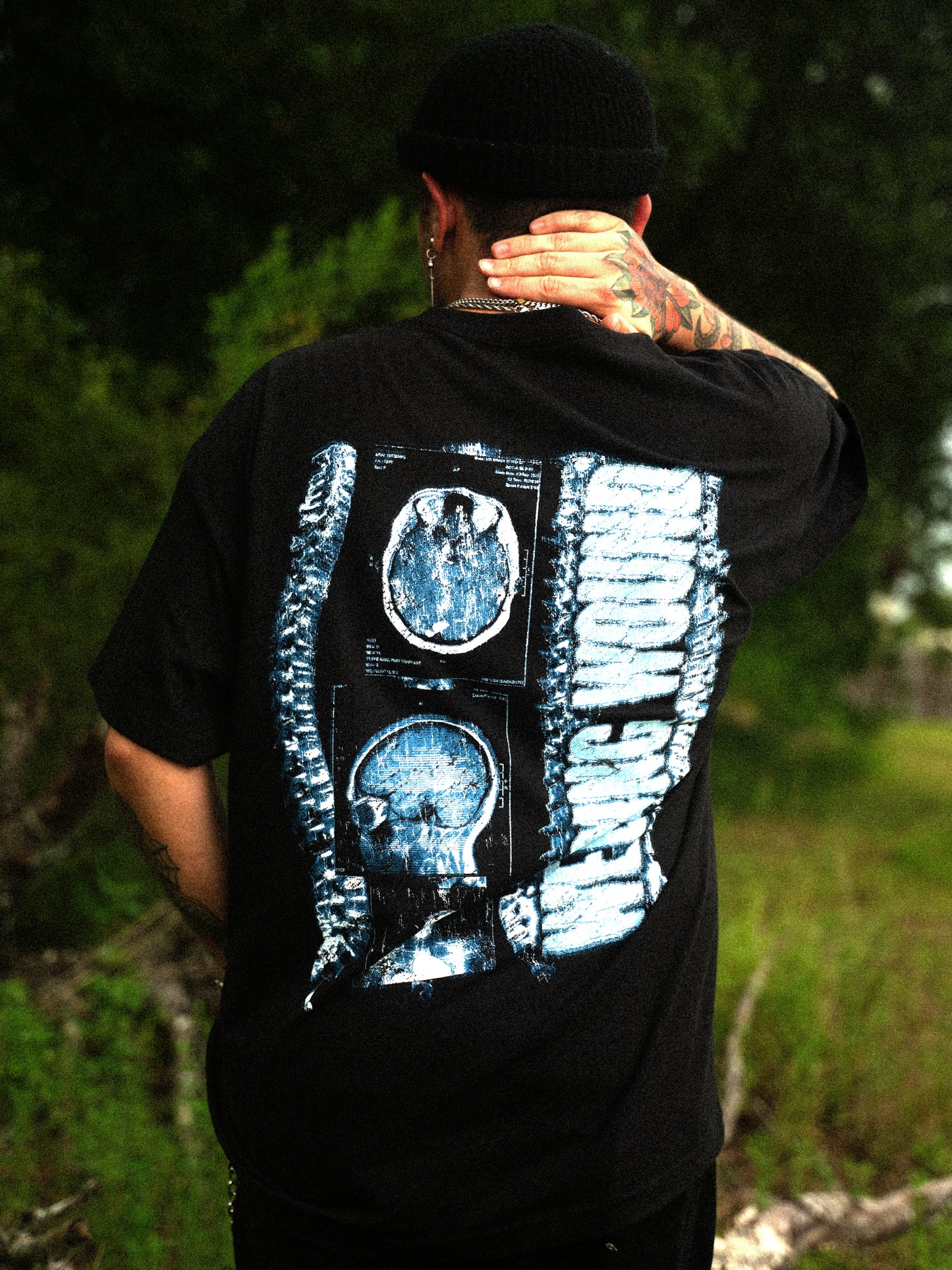 X-Ray Tee