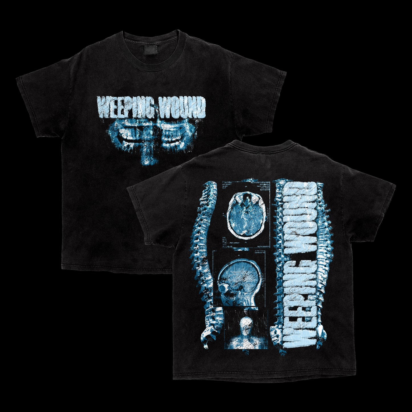 X-Ray Tee